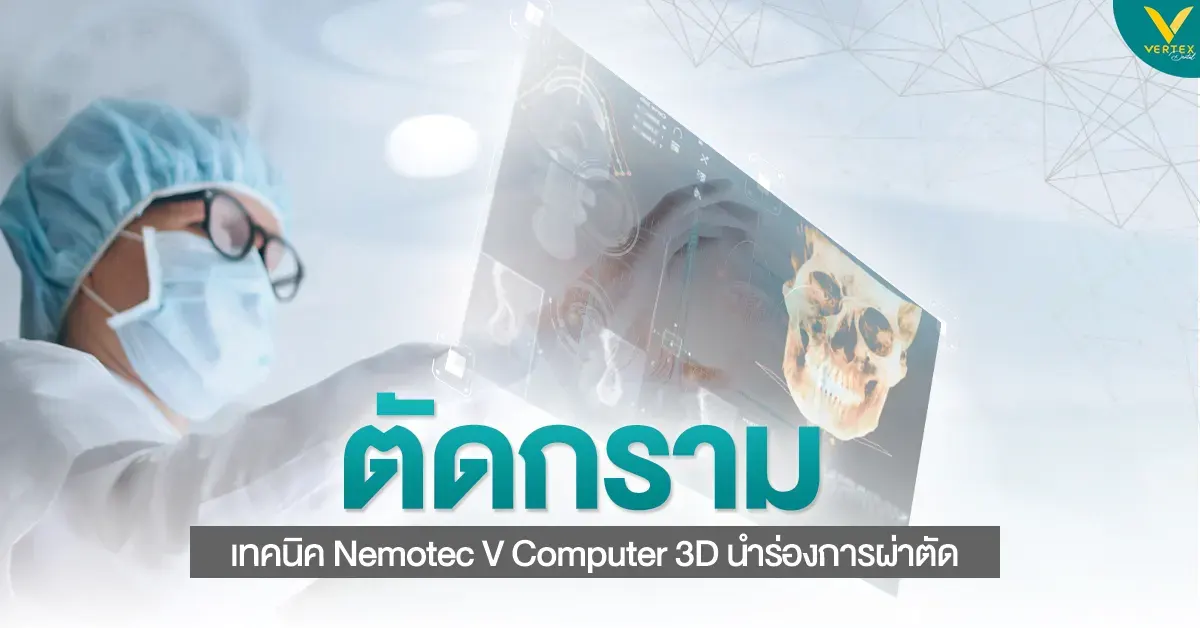 ตัดกราม เทคนิค Nemotec V