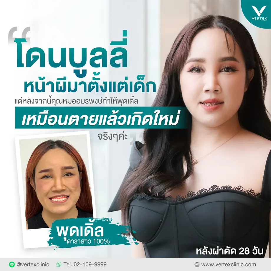 คุณพุดเดิ้ล