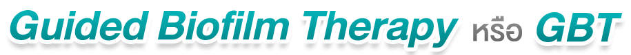 Guided-Biofilm-Therapy