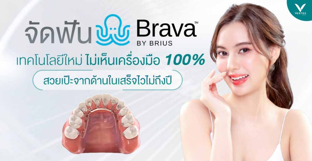 จัดฟันด้านใน Brava