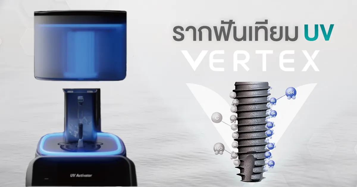 รากฟันเทียม uv