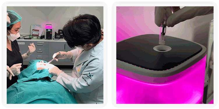 เคสรากฟัน-uv