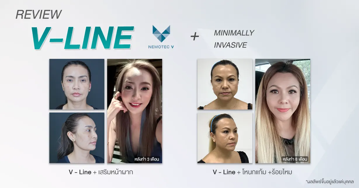 review v-line