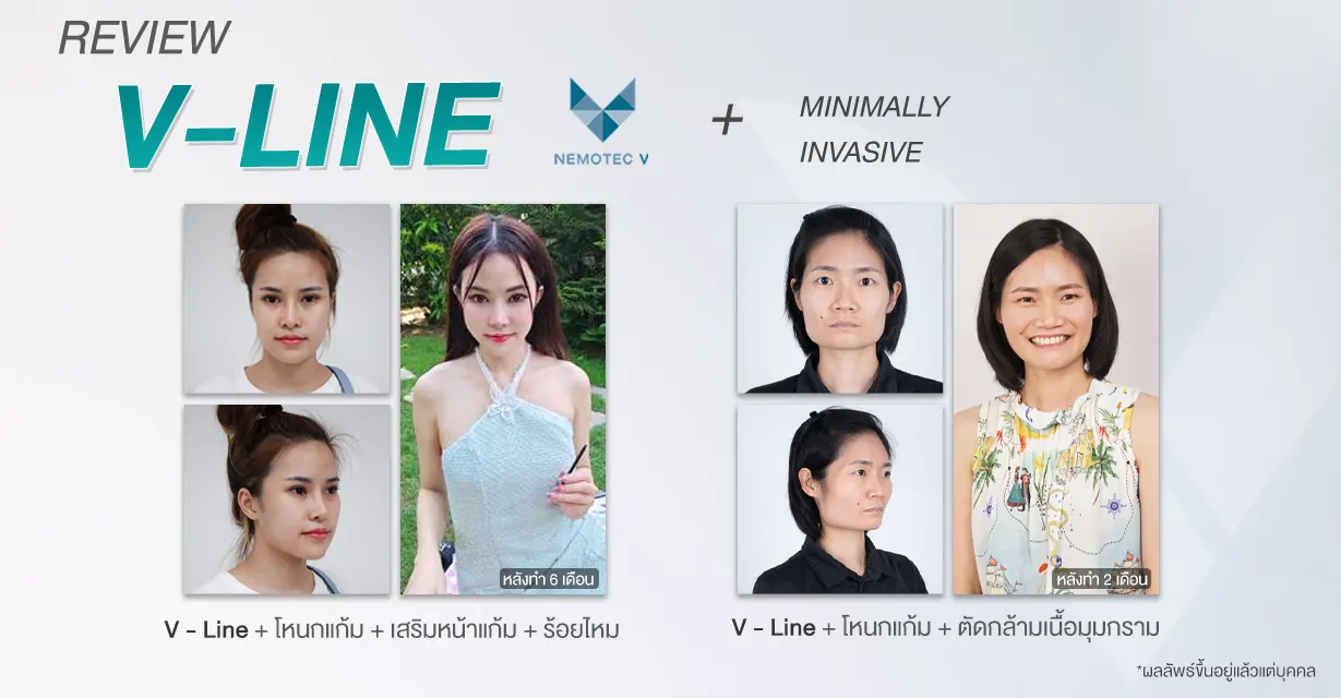review v-line