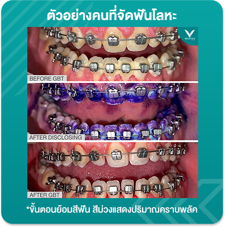 gbt Photo-L