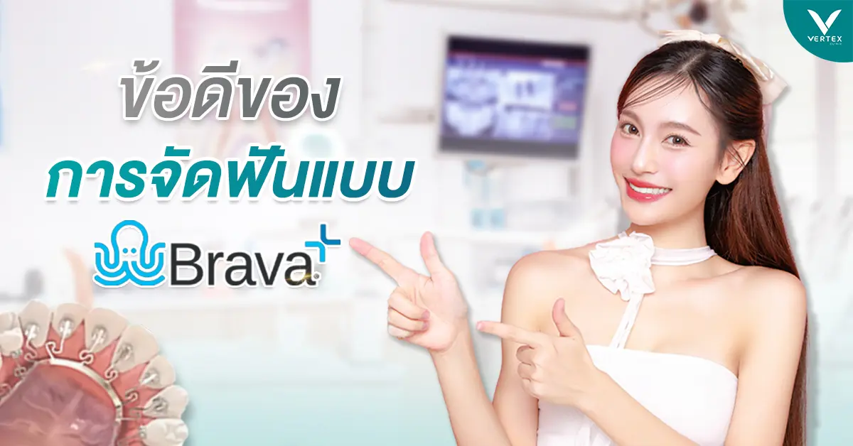 ข้อดีของการจัดฟันBrava