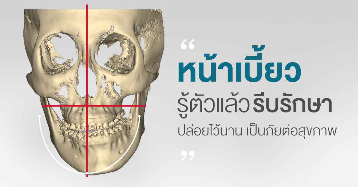 หน้าเบี้ยว รู้ตัวแล้วรีบรักษา ปล่อยไว้นานเป็นภัยต่อสุขภาพ