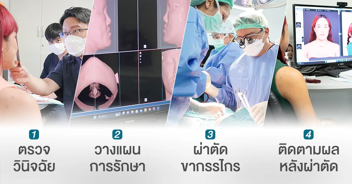 ขั้นตอนรักษาที่ Vertex Clinic