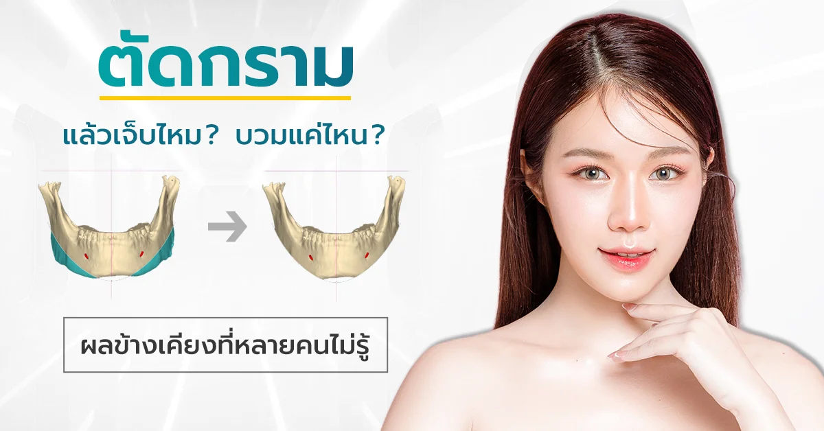 ตัดกราม ผลข้าง เคียง