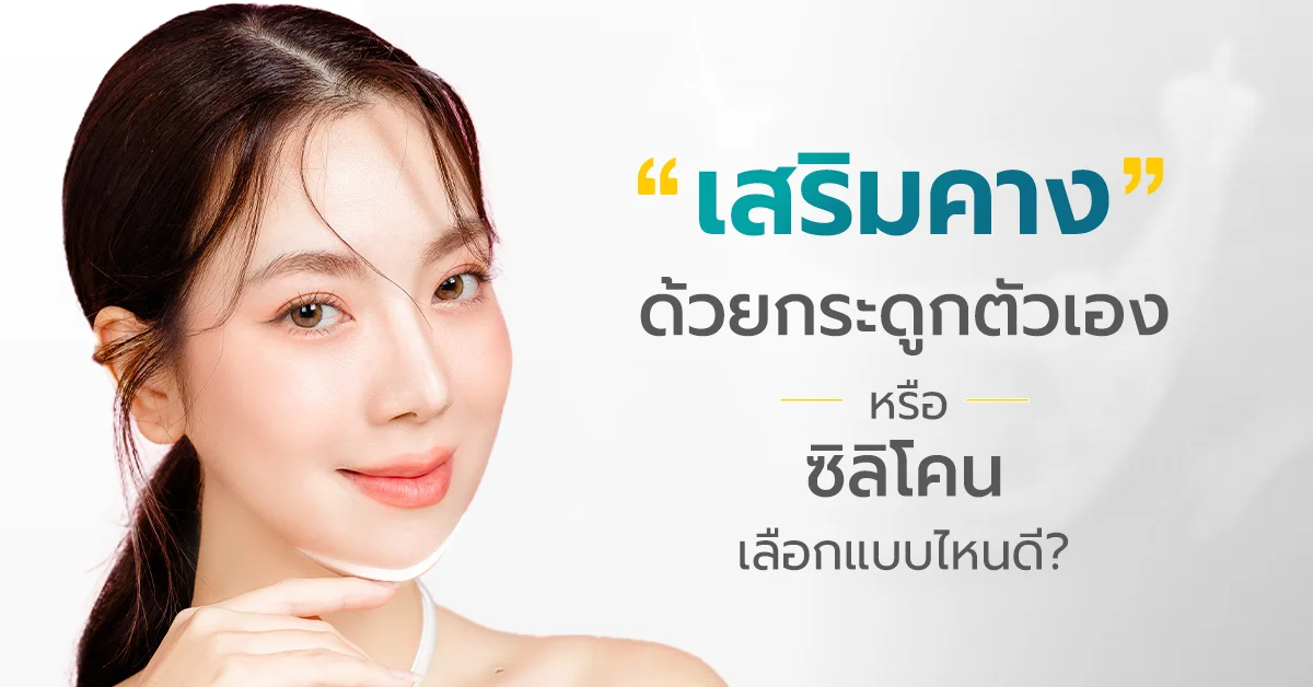 เสริมคาง กระดูกตัวเอง