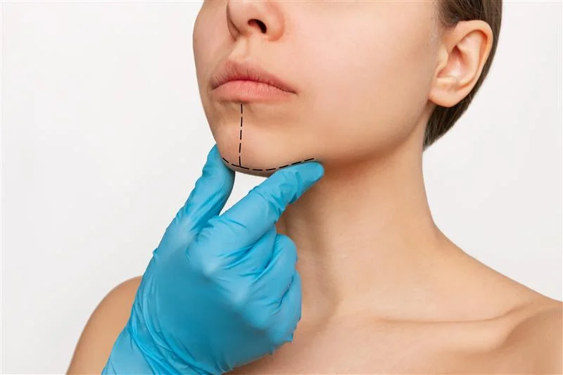 cropped-shot-young-caucasian-woman-with-marking-her-chin-facial-plastic-surgery