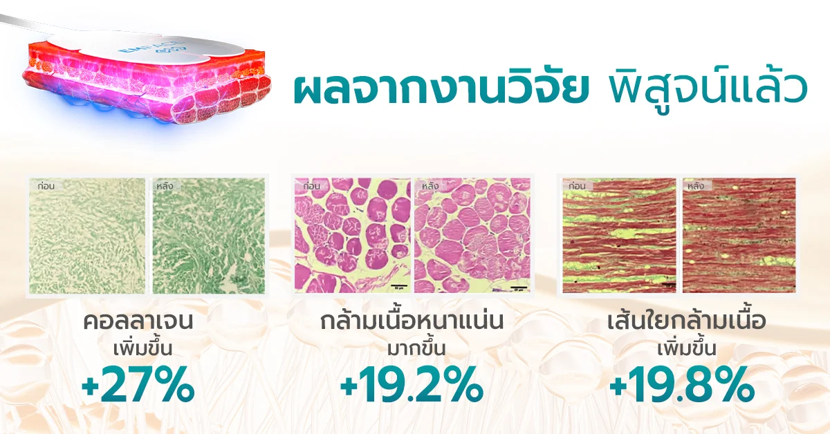 emface ผลจากงานวิจัย พิสูจน์แล้ว