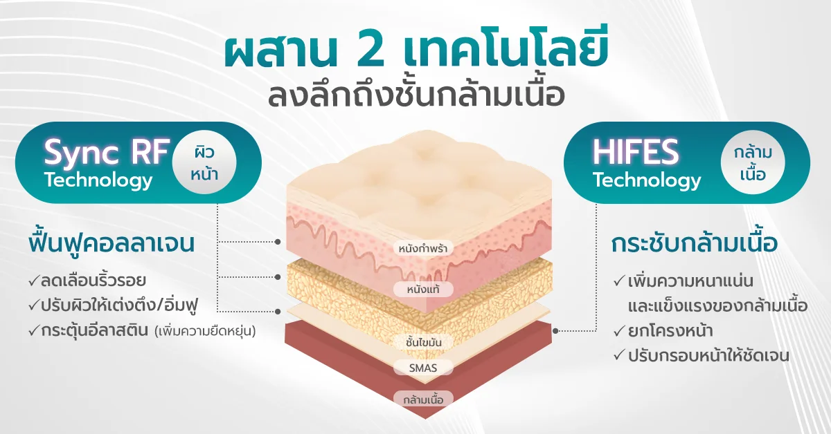 emface ผสาน 2 เทคโนโลยี